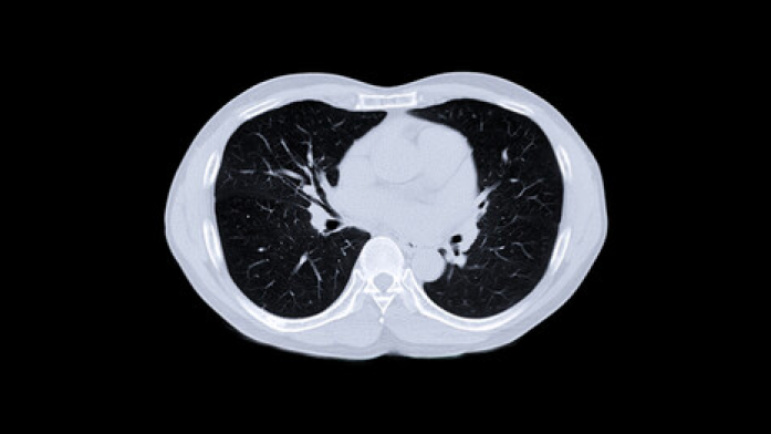 for_a_ra_ild_risk_score_9