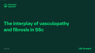The interplay of vasculopathy and fibrosis in SSc 