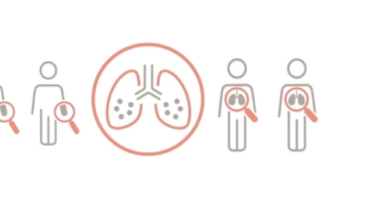 Listen to our experts  share their thoughts on what PF-ILD is and the high unmet need surrounding this disease