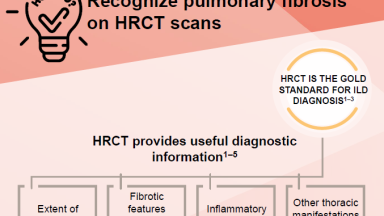PC-SC-102274-thumbnail